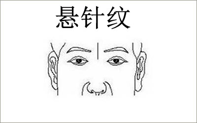 悬针纹好不好如何去掉悬针纹