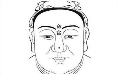 痣相