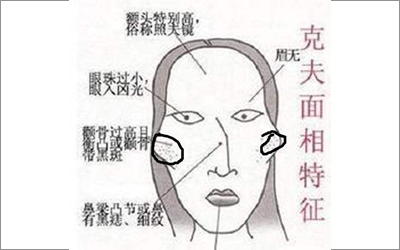 克夫相:克夫相是中国面相学中的其中一种面相,也称刑克配偶相.