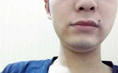 男人脸上哪里长痣可以招来桃花?-八字网