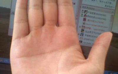 假断掌