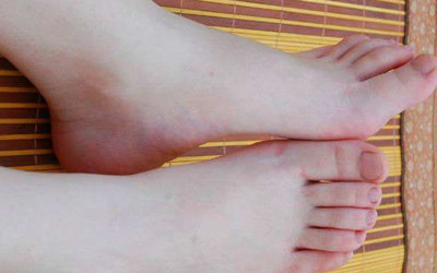 揭秘关于女人富贵命的一些脚型