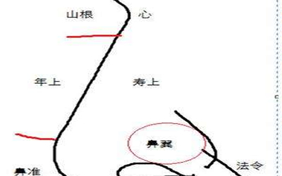 山根1