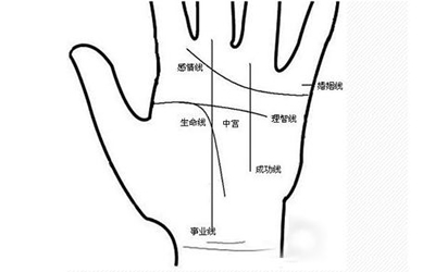 事业线14
