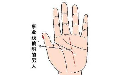 事业线25