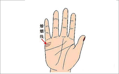 关于婚姻线下垂的几种形态是好还是坏呢