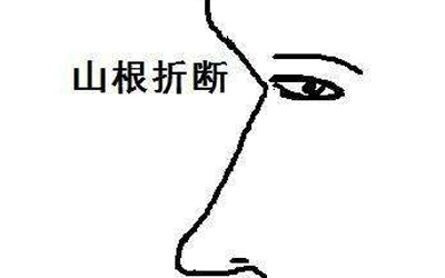 震惊山根断的人竟是这样的