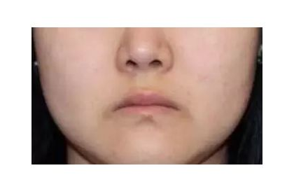 面相口角下垂如何化解