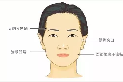相术