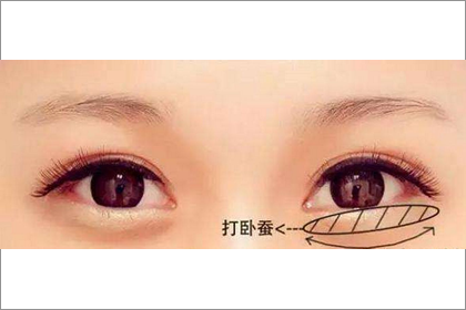 眼