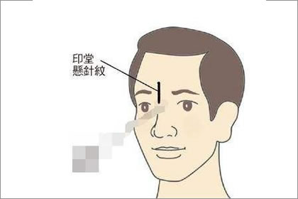 相术