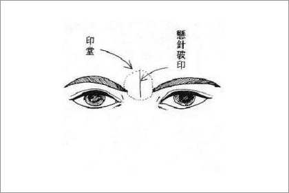 大师揭秘斩子纹面相是什么