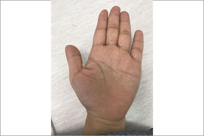 话说土形手的手相有什么特征