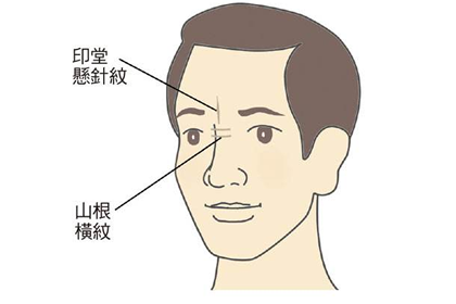 相术