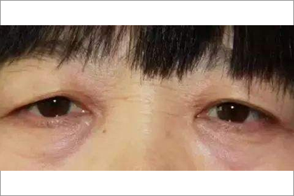 相术