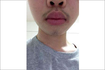 相术