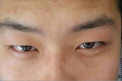相术