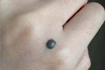 手上有痣怎么样揭秘手背有痣的男人