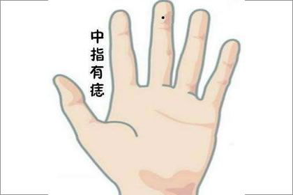手指长痣的位置示意图图片